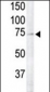 RSK4 Antibody (N-term)